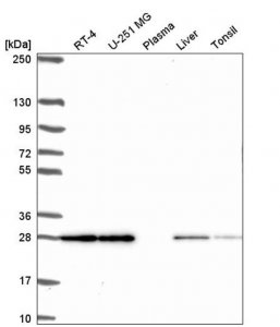 Anti-TMEM98 antibody produced in rabbit 