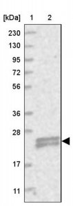 Anti-TMEM9B antibody produced in rabbit 