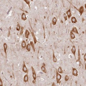 Anti-TMIE antibody produced in rabbit 