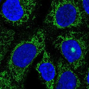 Anti-TMLHE antibody produced in rabbit 