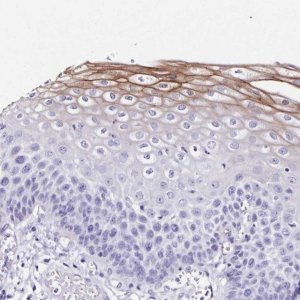 Anti-TMPRSS11E antibody produced in rabbit 