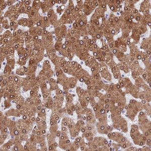 Anti-TMPRSS7 antibody produced in rabbit 