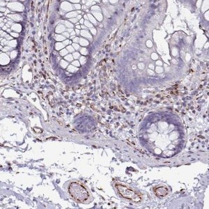 Anti-TMPRSS9 antibody produced in rabbit 