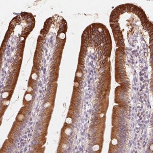 Anti-TMSB15B antibody produced in rabbit 
