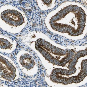 Anti-TMTC1 antibody produced in rabbit 