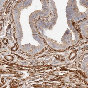 Anti-TMTC2 antibody produced in rabbit 