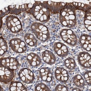 Anti-TMTC3 antibody produced in rabbit 
