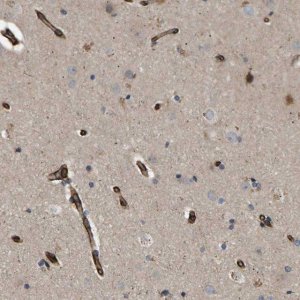 Anti-TMTC4 antibody produced in rabbit 