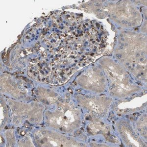 Anti-TMTC4 antibody produced in rabbit 