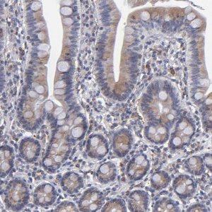 Anti-TMX1 antibody produced in rabbit 