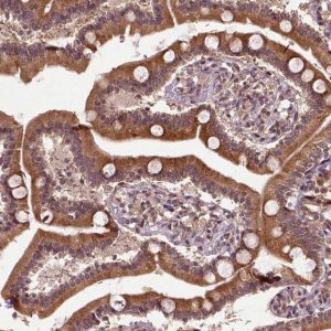 Anti-TMX2 antibody produced in rabbit HPA063763-100UL