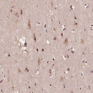 Anti-TMX2 antibody produced in rabbit HPA063763-100UL