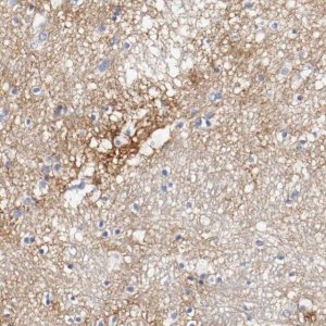 Anti-TNC antibody produced in rabbit 