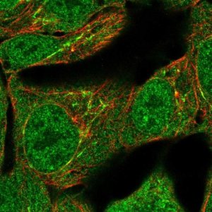 Anti-TNFAIP2 antibody produced in rabbit 