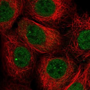 Anti-TNFAIP8 antibody produced in rabbit 