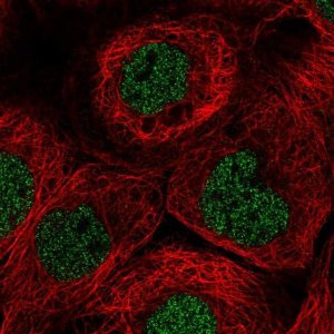 Anti-TNFRSF10A antibody produced in rabbit 