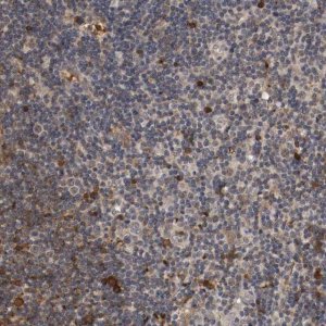 Anti-TNFRSF1B antibody produced in rabbit 