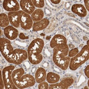 Anti-TNFRSF1B antibody produced in rabbit 