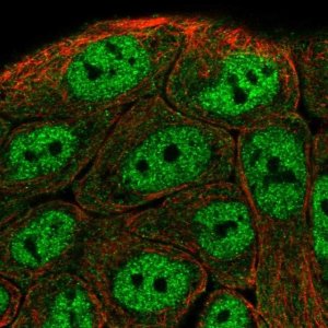 Anti-TNIP1 antibody produced in rabbit 