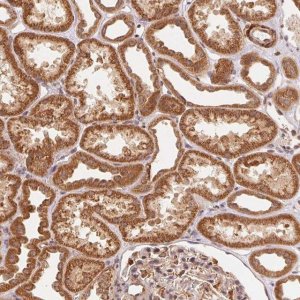 Anti-TNIP2 antibody produced in rabbit 