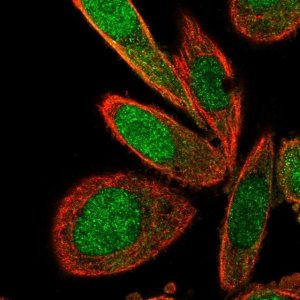 Anti-TNIP2 antibody produced in rabbit 