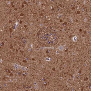 Anti-TNK2 antibody produced in rabbit 