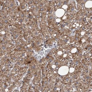 Anti-TNKS antibody produced in rabbit 