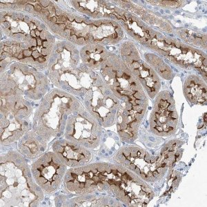 Anti-TNN antibody produced in rabbit 