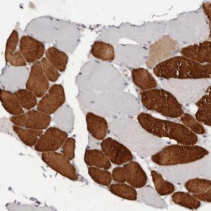 Anti-TNNI1 antibody produced in rabbit 