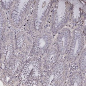 Anti-TNNI1 antibody produced in rabbit 
