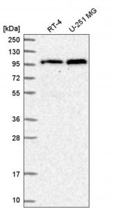 Anti-TNPO3 antibody produced in rabbit 