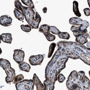 Anti-TNRC18 antibody produced in rabbit 