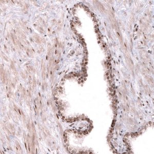 Anti-TNRC6A antibody produced in rabbit 