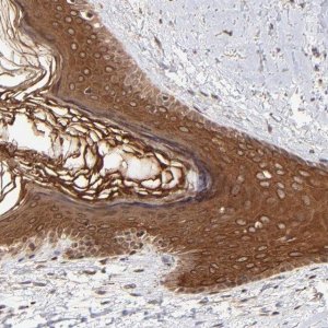 Anti-TNRC6B antibody produced in rabbit 