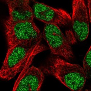 Anti-TNRC6C antibody produced in rabbit 