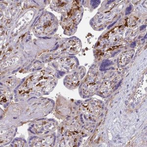 Anti-TNS3 antibody produced in rabbit 