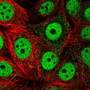 Anti-TOB1 antibody produced in rabbit 