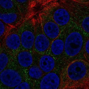Anti-TOB2 antibody produced in rabbit 