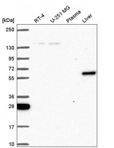 Anti-TOE1 antibody produced in rabbit 