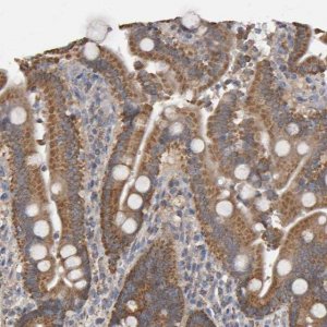 Anti-TOM1L1 antibody produced in rabbit 