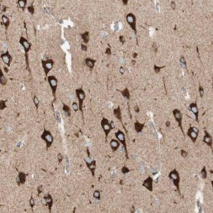 Anti-TOMM20 antibody produced in rabbit 