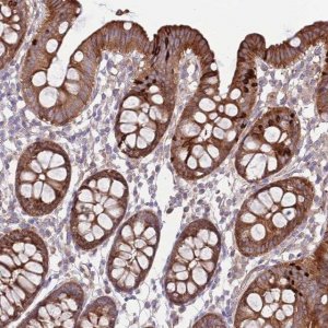 Anti-TOMM5 antibody produced in rabbit 