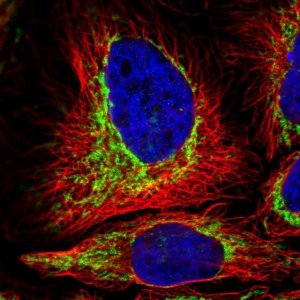 Anti-TOMM5 antibody produced in rabbit 