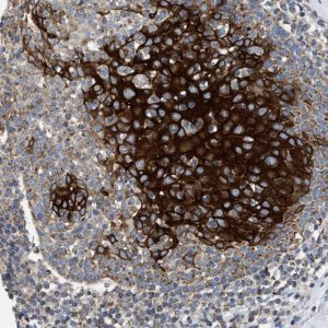 Anti-TOMM6 antibody produced in rabbit 