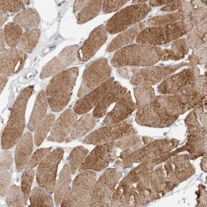 Anti-TONSL antibody produced in rabbit 