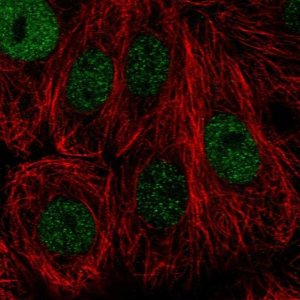 Anti-TONSL antibody produced in rabbit 