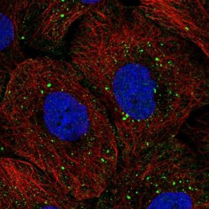Anti-TOP3B antibody produced in rabbit 