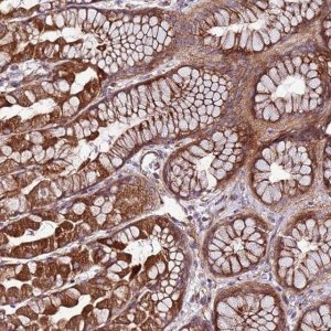 Anti-TOPAZ1 antibody produced in rabbit 