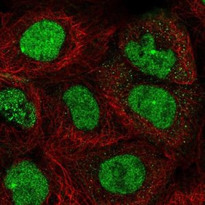 Anti-TOPBP1 antibody produced in rabbit 