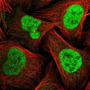 Anti-TOPBP1 antibody produced in rabbit 